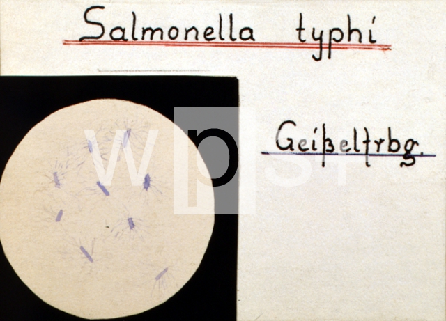 ｜コッホが描いたサルモネラ菌