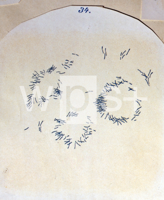｜コッホが描いた結核菌：死んだ巨大細胞のもとの場所に特色のある状態の結核菌