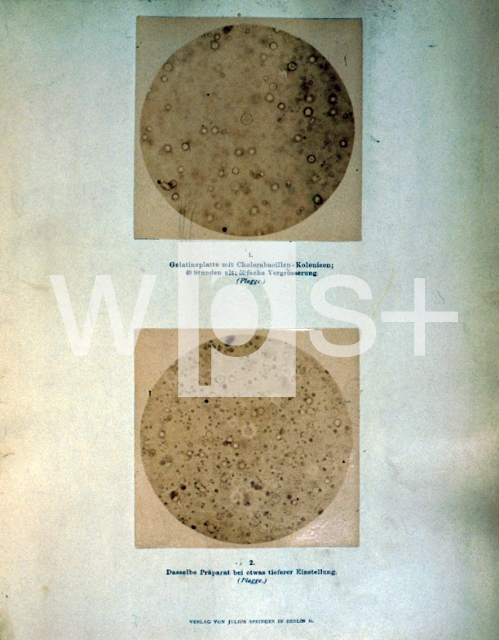 ｜コッホのコレラ菌の顕微鏡写真の原図