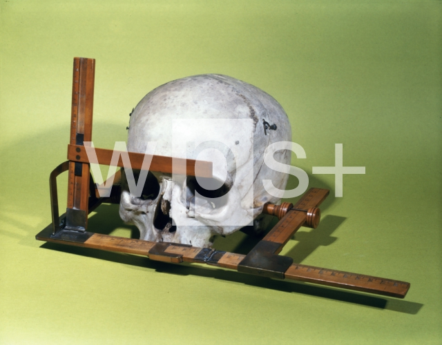 ｜ブローカの考案した頭骨の計測記載の方法（頭骨測角器）