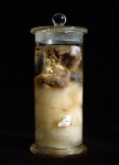｜コッホが準備した結核菌におかされた器官の標本