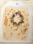 ｜コッホが描いた結核菌：巨大細胞の表面に対し垂直な縦軸をもつ特色ある状態の結核菌