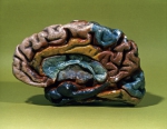 ｜石膏で作られた脳の半球模型